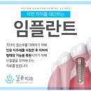 하얀고운치과의원 네이버블로그