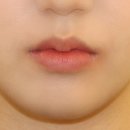 르에이치의원 이미지