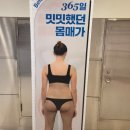 365엠씨(mc)병원 | 무한람스 팔뚝 비용, 상담, 시술 전 주의사항(병원초이스부터 람스결제까지)[팔뚝람스 1편]