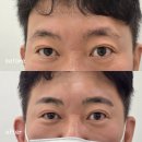 밸런스 바디디자인 | 부산남자눈썹문신 추천 인상 달라진 후기