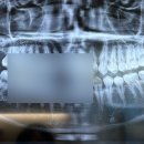 연세굿바이사랑니치과의원 이미지