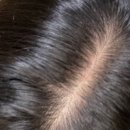 보령정한의원 | 미녹정 복용하는 분들 안보면 손해에요