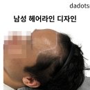 응달말로30 | 구리두피문신 후기｜30대 남성의 달라진 인상, 탈모에서 자신감으로!