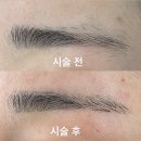 비니드니 | [수성구] 저온, 저통증으로 매끈한 피부관리 / 효성병원 근처 <비니드왁싱> 눈썹 왁싱 상세 후기