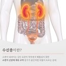 PCN 티스토리