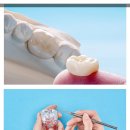 클라리티치과의원 | 대전치과 여러 건강 요소 가운데 구강에 대한 건강을 지키고 싶다면?