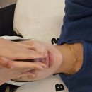 더빅스 | 청담 줄기세포주사 셀빅스 후기 고압산소쳄버까지