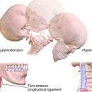 둔산튼튼한의원 이미지