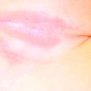 눈꽃피부과의원 이미지