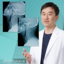 바른자세자연치유연구소 | 목디스크 고민 끝 바른척추연구소 경추배게 숙면배게 솔직 사용후기