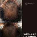 모스테틱광주
