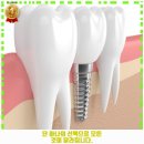 탑플란트치과의원 | 도사동 내과 365서울탑플란트치과의원 순천 가격 및 후기 추천 리뷰 주차 예약 알아봐요