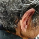 제일의료기보청기 이미지