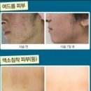 뉴미인