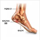 솔한방병원 네이버블로그
