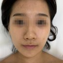 [잠실새내] 프롬미 잠실점/샤넬물광필 프로그램/잠실웨딩관리,신부관리,예비신부관,웨딩케어
