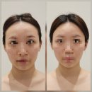 내돈내산 안산 피부관리, 소연재 에스테틱 3회차 후기