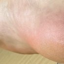 메디레스큐 이미지