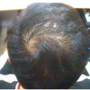 이성미베스트의원 | 평택 두피 관리 - 이성미 베스트 의원의 노하우!