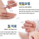 바른몸힘한의원 네이버블로그