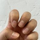 금붕어네일 이미지