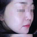 강남타토아의원 이미지