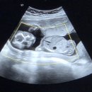 라임산후조리원 이미지