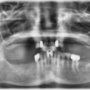 종로미시간치과의원 이미지