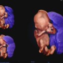 청아여성의원 이미지