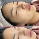 에이블메디스킨 로고