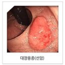 대장 이미지