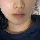 마로니에치과 이미지