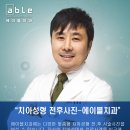 에이블치과기공소 네이버블로그
