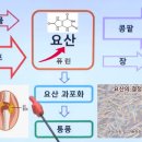 통풍 뇨산 류마티스에서 해방하려면~?? 이미지