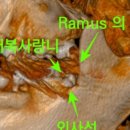 연세일등치과 이미지