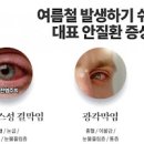 눈병 유행성 알레르기성 결막염 및 원인 전염 안약 이미지