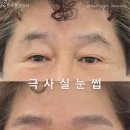 스칼프랩앤뷰티 속눈썹&눈썹&탈모 의정부점 이미지