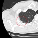ct 사진 한번 보아주세요 이미지