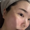 필의류 | 동대문피부관리 트로이필 효과 제대로 본 후기 (앤올리브에스테틱)