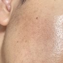 (유)연합가축약품 | 리쥬비더마 PDRN 크림 체험단 생생 후기