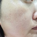 리젠테크 수분크림 닥터에스리젠크림 속건조 잡아준 보습크림 사용후기