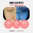 썸블리의원 네이버블로그