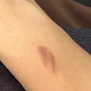 에이스뽑기방 | "D-3, 제 인생이 72시간 뒤에 정지될 예정입니다"