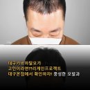 FROM.B헤어 | 탈모가 고민이라면??리게인프로젝트 대구본점에서 확인하자! 풍성한 모발과 자연스러운 헤어라인 변화 후기