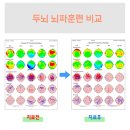 브레인리더한의원 이미지