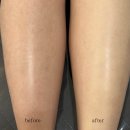 리누에스테틱 이미지