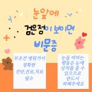 눈에 검은 점이 생기는 이유? 세종 아이닉안과 의원 추천해요.