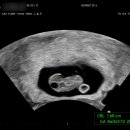 봄빛병원(산후조리원 포함) 이미지