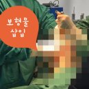 에스제이길비뇨기과의원 | [울산 모티바가슴성형] 50대 지인 추천이 많은 이유, 처진 가슴 고민 해결 (해부학 박사 집도)
