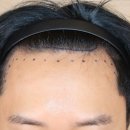 움찬의원 이미지